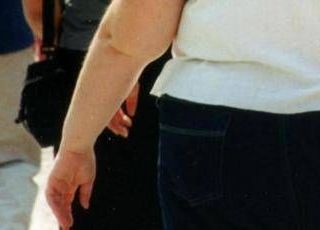 Una morte per malattie infettive su 10 è legata all'obesità, lo studio