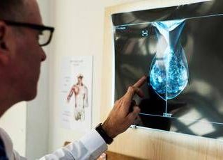 Cancro al seno, crioablazione nuova frontiera di cura