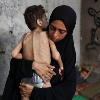 Gaza, una mamma abbraccia suo figlio denutrito  (MAHMOUD ISSA)