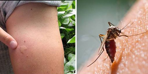 Quali repellenti per difendersi dalla zanzare?