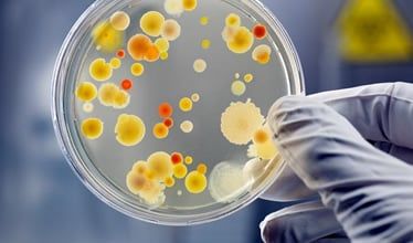 Microbiologia 'trasloca' dalla Usl all'ospedale Parini Microbiologia 'trasloca' dalla Usl all'ospedale Parini