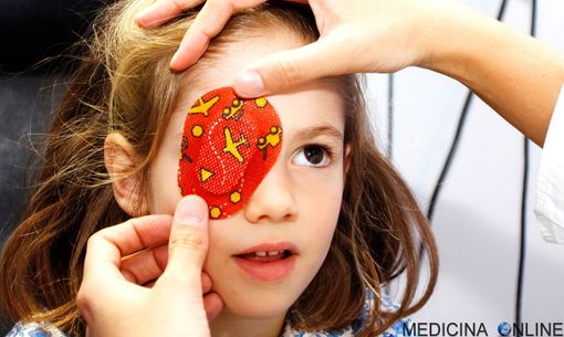 Il 10% dei bambini valdostani ha 'l'occhio pigro Il 10% dei bambini valdostani ha 'l'occhio pigro