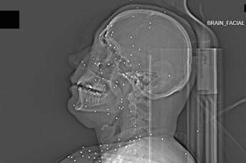 L'inchiesta horror sulle violenze iraniane: 'Manifestanti uccisi e colpiti nelle parti vitali' L'inchiesta horror sulle violenze iraniane: 'Manifestanti uccisi e colpiti nelle parti vitali'