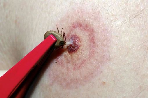 Al Pronto soccorso del Parini la lotteria del codice di dimissione Al Pronto soccorso del Parini la lotteria del codice di dimissione