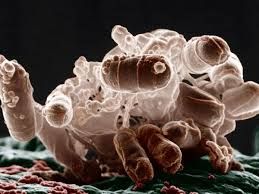 ALIMENTI: Batteri resistenti agli antibiotici nell’84% della carne di pollo analizzata, denuncia Altroconsumo ALIMENTI: Batteri resistenti agli antibiotici nell’84% della carne di pollo analizzata, denuncia Altroconsumo