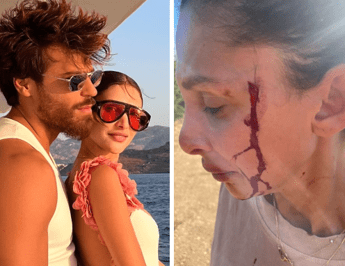 Can Yaman, la fidanzata Sara Bluma denuncia le violenze dell'ex. L'attore: "Ti amo" Can Yaman, la fidanzata Sara Bluma denuncia le violenze dell'ex. L'attore: "Ti amo"