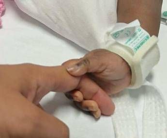 Gemelle siamesi separate al Gaslini di Genova: "Estubate, respirano da sole" Gemelle siamesi separate al Gaslini di Genova: "Estubate, respirano da sole"