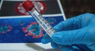 Su 205 persone testate sono quattro i positivi Covid in Valle Su 205 persone testate sono quattro i positivi Covid in Valle