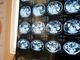 Neurologi: &quot;Noi fondamentali in gestione neoplasie cerebrali&quot;