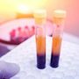 Farmaci, Sava (Sif Magazine): &quot;In plasmaderivati attenzione particolare a sicurezza&quot;