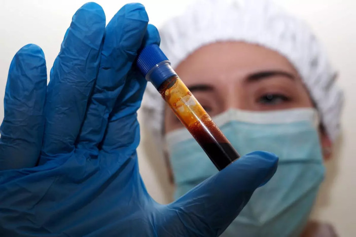 Allerta Hantavirus: il Monitoraggio della Situazione Internazionale