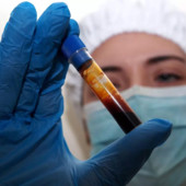 Allerta Hantavirus: il Monitoraggio della Situazione Internazionale