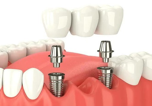 Odontoiatria sociale, il primo anno dà risultati: ora serve una svolta per rendere il servizio più forte e tempestivo Odontoiatria sociale, il primo anno dà risultati: ora serve una svolta per rendere il servizio più forte e tempestivo