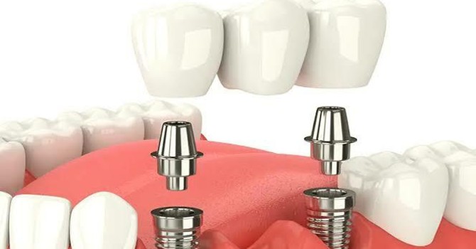 Odontoiatria sociale, il primo anno dà risultati: ora serve una svolta per rendere il servizio più forte e tempestivo Odontoiatria sociale, il primo anno dà risultati: ora serve una svolta per rendere il servizio più forte e tempestivo