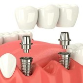 Odontoiatria sociale, il primo anno dà risultati: ora serve una svolta per rendere il servizio più forte e tempestivo