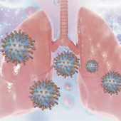 Virus respiratorio sinciziale, copertura neonatale ok ma rischio equità per anziani e fragili Virus respiratorio sinciziale, copertura neonatale ok ma rischio equità per anziani e fragili