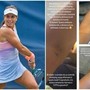 US Open, Stefanini e il livido sul braccio: "Colpa di un controllo antidoping..."