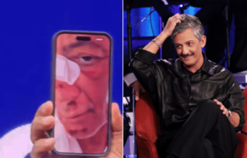 Fiorello, l'incidente in bicicletta: "Volevo fare il figo... sono caduto di faccia"