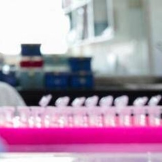 Milano, focolaio di tubercolosi all'Istituto di Medicina legale: 8 casi conclamati e 7 positivi. Indagini sull'origine del contagio Milano, focolaio di tubercolosi all'Istituto di Medicina legale: 8 casi conclamati e 7 positivi. Indagini sull'origine del contagio
