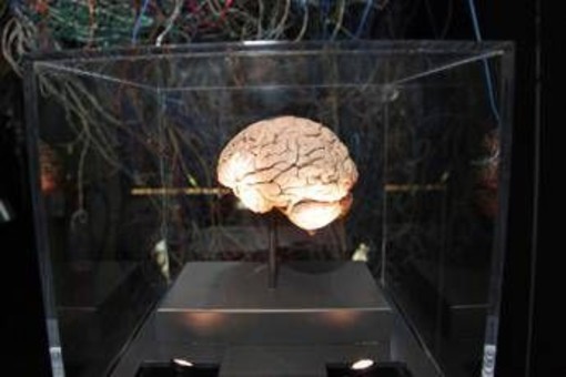 Medicina, neurologi: "L'innovazione può cambiare la storia di molte malattie ma serve equità"
