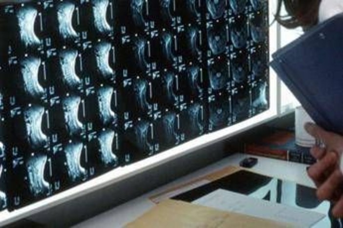 Oltre 500 malattie rare delle ossa, esperti: "Investire in prevenzione e diagnosi"