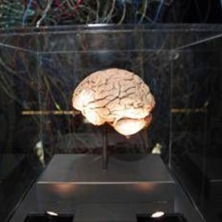 Medicina, neurologi: "L'innovazione può cambiare la storia di molte malattie ma serve equità"