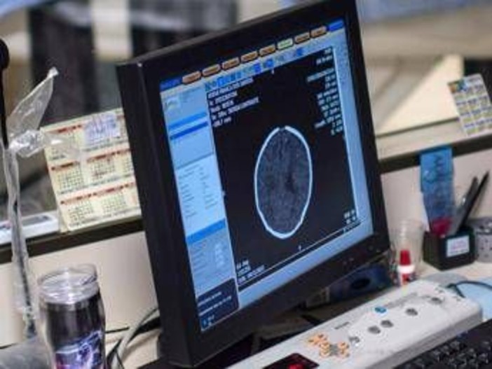 Salute, Padovani (Sin): "Longevità aumenta rischio Alzheimer, agire su prevenzione"