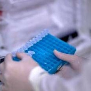 Scoperto il virus gigante Ushikuvirus, lo studio: "Può darci indizi su origine della vita" Scoperto il virus gigante Ushikuvirus, lo studio: "Può darci indizi su origine della vita"