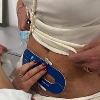 Esplorare l'apparato digerente con una 'pillola', come funziona la videocapsula endoscopica