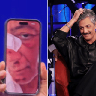 Fiorello, l'incidente in bicicletta: "Volevo fare il figo... sono caduto di faccia"