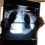 Sirm: "Ai strumento anti liste d'attesa, 50% esami imaging per over70 non necessario" Sirm: "Ai strumento anti liste d'attesa, 50% esami imaging per over70 non necessario"