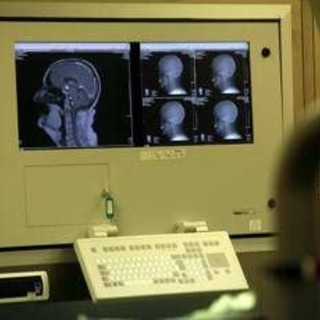 Medicina: Congresso Sin, neurologia tra innovazione, responsabilità e nuova organizzazione
