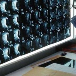 Oltre 500 malattie rare delle ossa, esperti: "Investire in prevenzione e diagnosi"