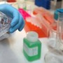Cancro alla vescica, Berardi (Aiom): "Sangue nelle urine segnale da non sottovalutare"