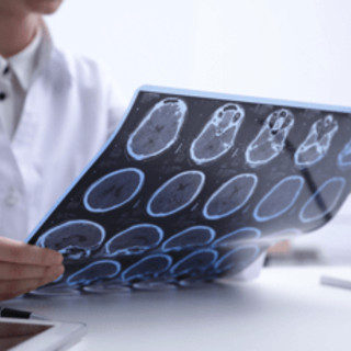 Salute, psicologa Borghi: "Oltre la sclerosi multipla un percorso verso il futuro"