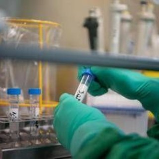 Tumori, lo studio: scoperto interruttore molecolare per 'riconvertire' le cellule maligne