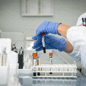 Cordoma del sacro, italiano il primo studio al mondo sull'efficacia dell'adroterapia